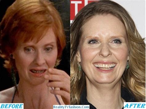 cynthia nixon teeth|cynthia nixon close face.